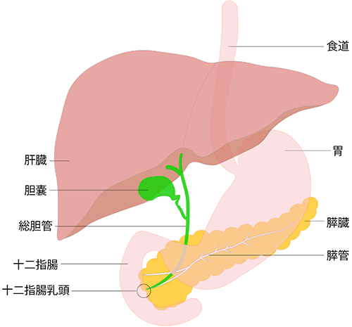 胆石症とは